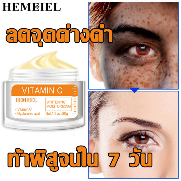 hemeiel-ครีมแก้ฝ้าแท้ๆ-เซรั่มรักษาฝ้า-บอกลาปัญหากระ