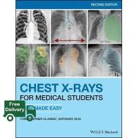 Good quality, great price &amp;gt;&amp;gt;&amp;gt; Chest X-Rays for Medical Students : CXRs Made Easy, 2ed - 9781119504153