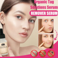 Organic Tags Solutions Serum Painless Mole Skin Dark Spot Remover Serum Face Wart Tag Freckle Removal Cream Oil Plaster