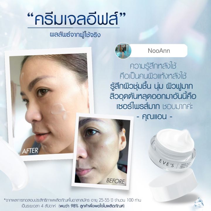 eves-ครีมเจลอีฟส์-ครีมบำรุงผิวหน้า-มอยเจอร์ไรเซอร์บำรุงผิวหน้า-white-reveal-brightening-cream-gel-คนท้องใช้ได้-5-กระปุก