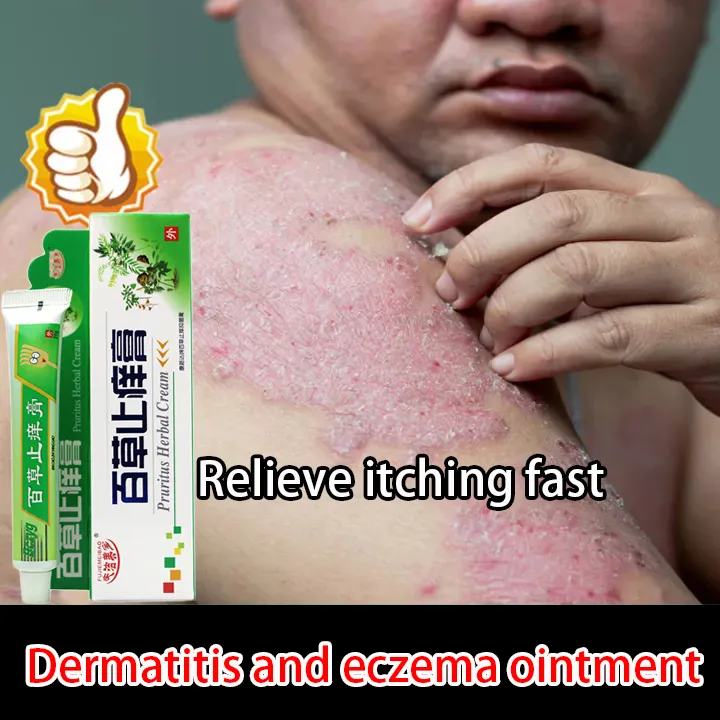 Eczema Treatment Cream Antibacterial Ointment for Itchy Skin and