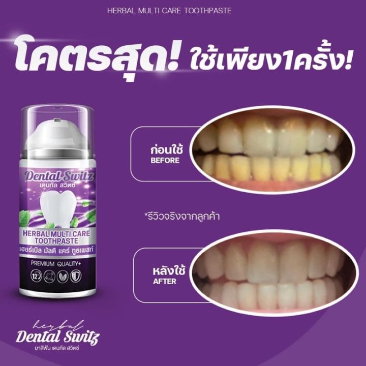 ซื้อฟอกฟัน-1-เเถมฟรีรางฟัน-1-dental-switz-หินปูน-กลิ่นปาก-เหงือกอักเสบ-คราบฟัน-ฟันขาวไม่ต้องฟอก