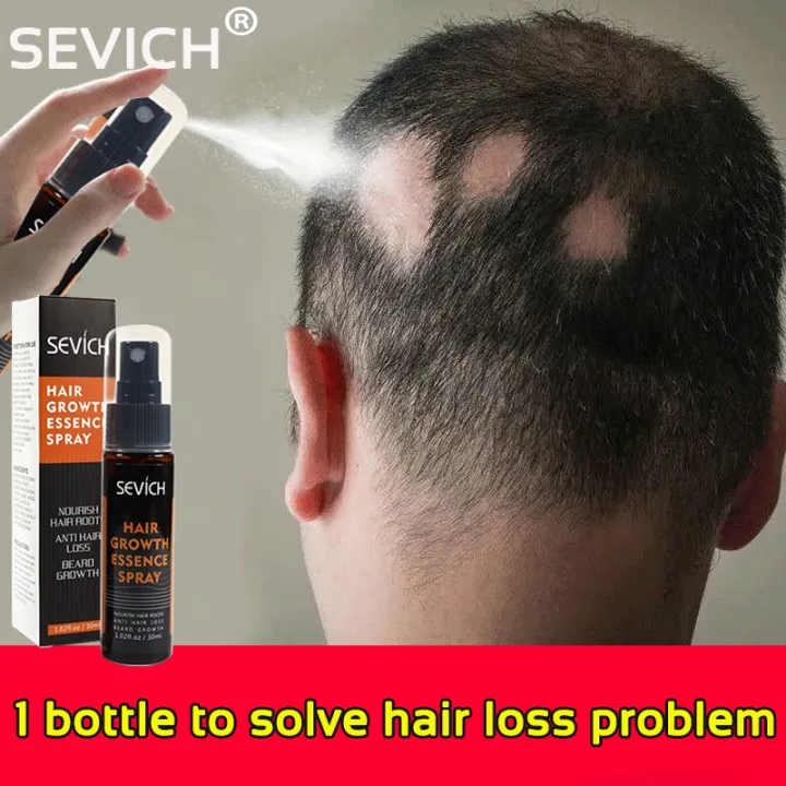 Prevent Hair Loss Hair SEVICH Growth Spray 30ML Strengthen The Nutrition Of  Hair Root Accelerate Hair