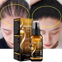 【cw】 Biotin Hair Growth Products Fast Growing Hair Essential Oil Hair Care Prevent Hair Loss Scalp Treatment For Men Women New 2022