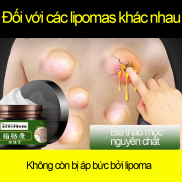 Kem u mỡ kem loại bỏ u mỡ dưới da kem mát xa cục u dưới da sắc thuốc thảo