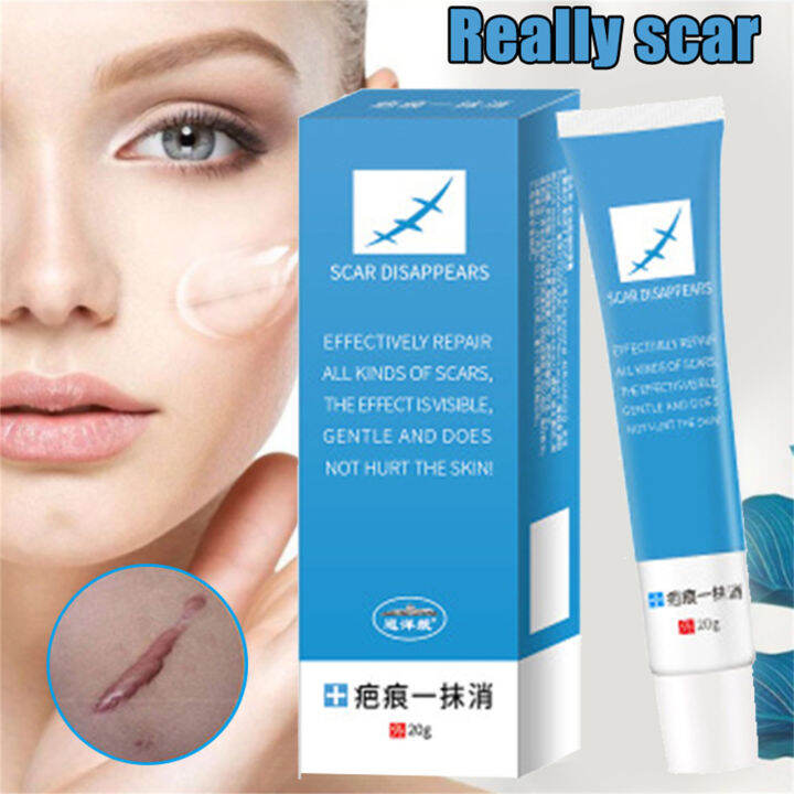 Body Scars Lighten & Repair Gel Natural Ingredient Effectively Scar 