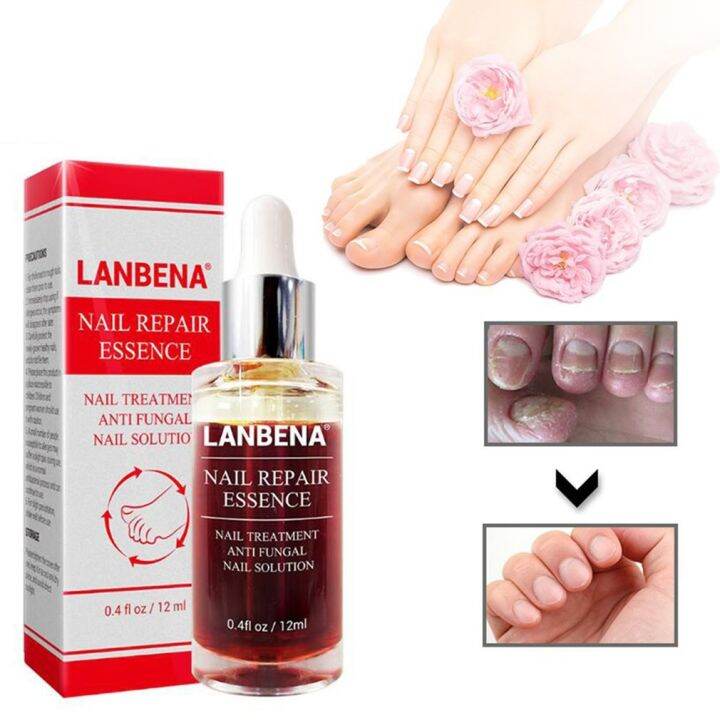 LANBENA Nail Repair Essence Fungal Onychomycosis Nourishing 15 ml