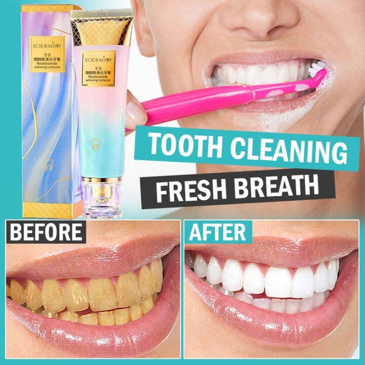 Nicotinamide Toothpaste Teeth Whitening Toothpaste Yellow Teeth Tartar