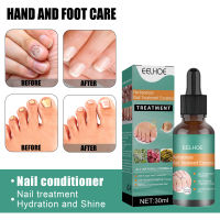 Eelhoe Gray Nail Repair Essence Hand And Foot Nail Soft Nail Thickening Bright Nail Manicure Concave And Convex Nail Care Solution