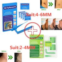 【CW】✥┇∋  Tag Remover Band Papilloma Removal Patches skin cleaning Tools Freckle Wart