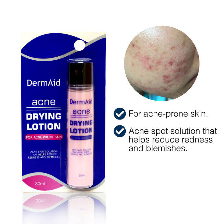 DermAid Acne Drying Lotion 30ml Lazada PH