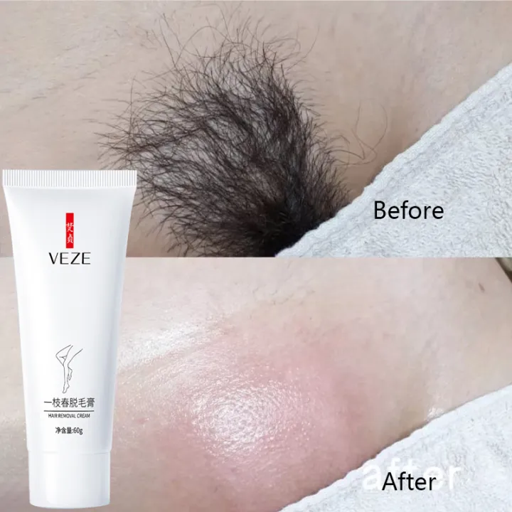 Hair removal cream, hair removal under the armpit, hair removal wax, hair  removal on the lips,