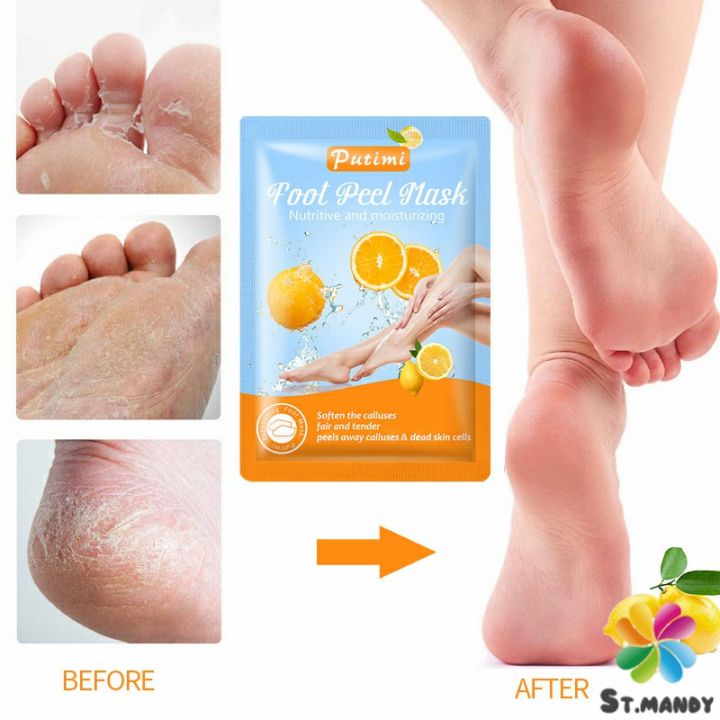 md-มาสก์เท้า-ช่วยผลัดเซลล์ผิว-1-คู่-ถุง-ขจัดเซลล์ผิวที่ตายแล้ว-ให้ความชุ่มชื่นแก่เท้า-foot-membrane