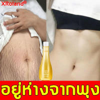 ส่งวันนี้！！ XUANLUOLAN ครีมทารอยแตกลาย150ml มีสารพืชหลายชนิด พุงเรียบ เต่งตึง ราวกับแพรไหม(แก้แตกลาย ลดผิวแตกลาย ครีมลดรอยแตกลาย ครีมทารอยแตก ครีมทาท้อง ครีมทาท้องลาย ครีมท้องลาย โลชั่นทาท้องลาย ครีมลดรอยแผลเป็น ครีมแก้ท้องลาย ครีมท้องแตกลาย