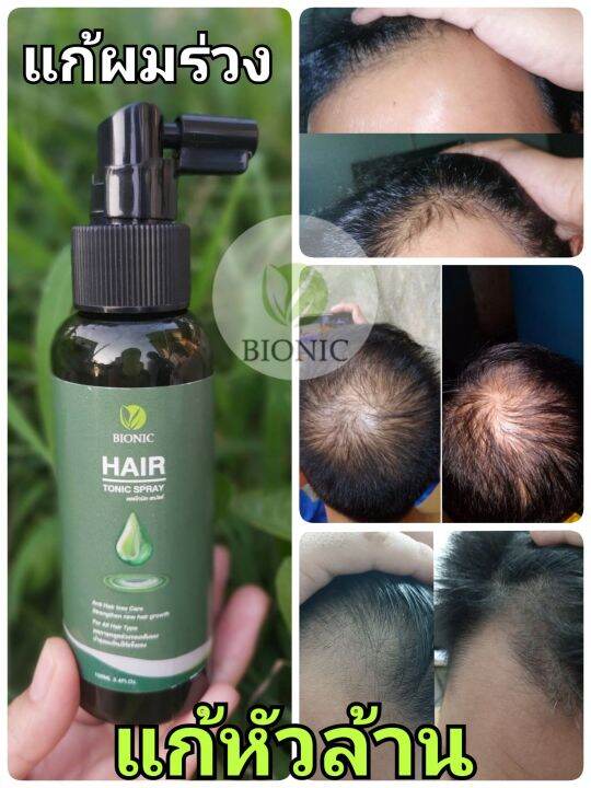 bionic-hair-tonic-spray-100ml-ผลิตภัณฑ์-ไบโอนิค-แฮร์โทนิค-สูตรเข้มข้น-บำรุง-เส้นผมและหนังศีรษะ-1ชิ้น