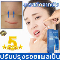 【จัดส่งที่รวดเร็ว】EELHOE ครีมทารอยแผลเป็น กำกัดแผลเป็นทุกชนิดได้อย่างมี ซ่อมแซมรอยแผลต่างๆ ฟื้นฟูผิวให้แข็งแรง（ครีมทาแผลนูน ครีมทาแผลเป็น ครีมแผลเป็น ยาทาแผลเป็นนูน ครีมลบรอยแผล ครีมลบรอยแผลเป็น ครีมรอยแผลเป็น ครีมลดแผลเป็น ลดแผลเป็น）