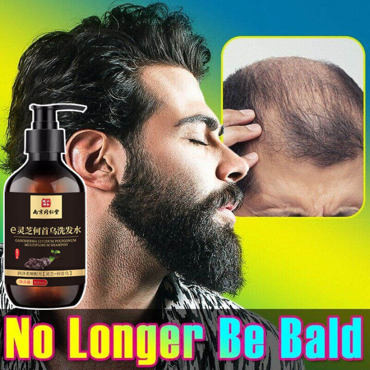 Black Ganoderma hair growth shampoo white hair turn Black hair prevent hair loss Postpartum