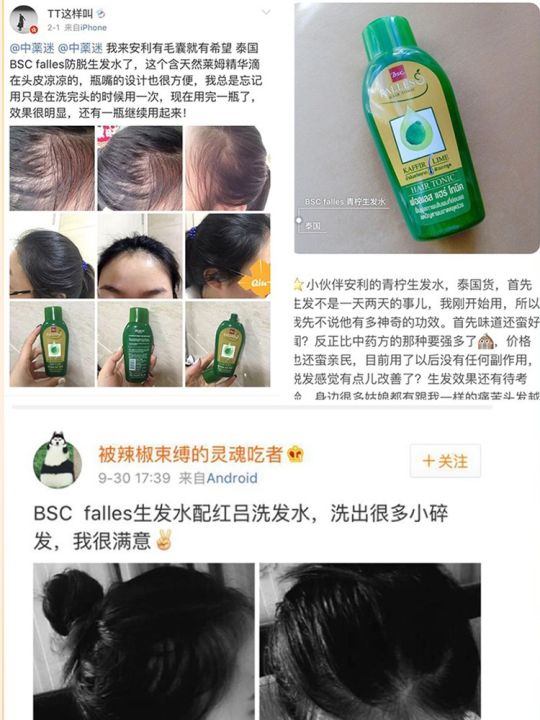 explosive-models-lion-king-bsc-falls-lyme-essence-anti-hair-loss-hair-liquid-solid-silicone-oil-shampoo