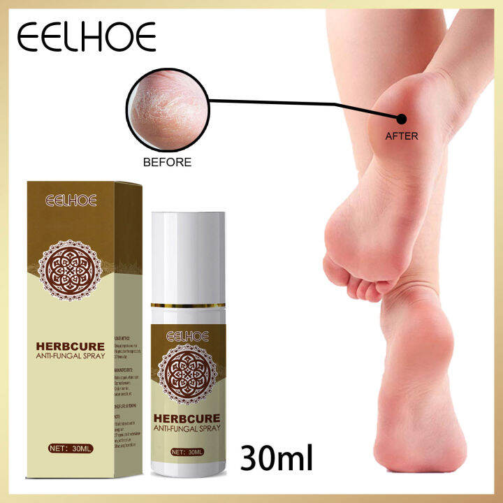 Eelhoe Nail Fungus Removal Spray Treatment Paronychia Onychomycosis