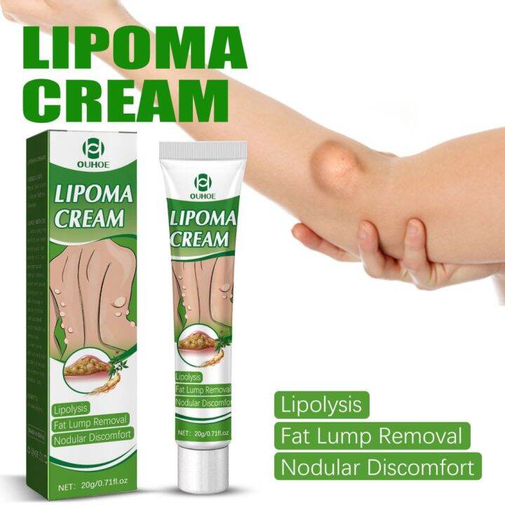 OUHOE Lipoma Removal Cream Lipolysis Fat Lump Relieve Plaster Skin ...