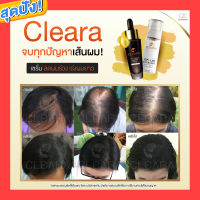 Cleara เคลียร่า เซรั่มปลูกผม ขนาด 15 ml. โปรโมชั่นสุดคุ้ม ( 2 ขวด 560 ) ส่งฟรี