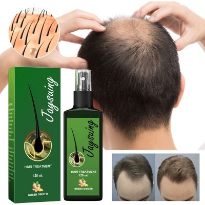 【cw】 30/120ML New Ginger Hair Growth Products Fast Growing Hair Essential Oil Prevent Hair Loss Oil Scalp Treatment For Men Women ！