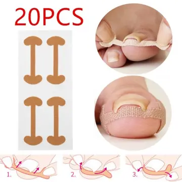 Silicone Nail Tools Stickers Toenail Correction Straightener