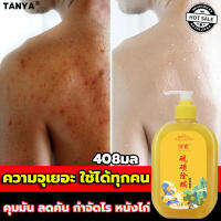 TANYA เจลอาบน้ำ สบู่อาบน้ำ ครีมอาบน้ำ ครีมอาบน้ำหอมๆ 408ML โฟมเยอะ อ่อนโยนไม่ระคายเคือง กำจัดไร ล้างให้มีผิวสวยใสไร้สิวออกมา บอกลาผิวหยาบกร้าน ครีมอาบน้ำเด็ก ครีมอาบน้ำขาว เจลอาบน้ำกลิ่นหอมละมุน มูสเจลอาบน้ำ เจล สบู่เหลวอาบน้ำ เจลอาบน้ำควา shower gel