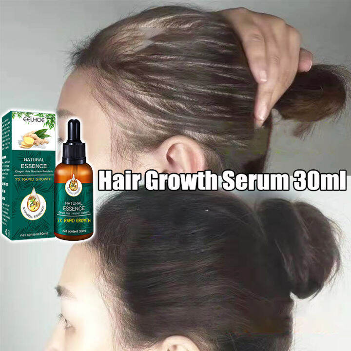 Hair Growth Serum 30ml Anti Preventing Hair Loss Alopecia Liquid Damaged Hair Repair Growing