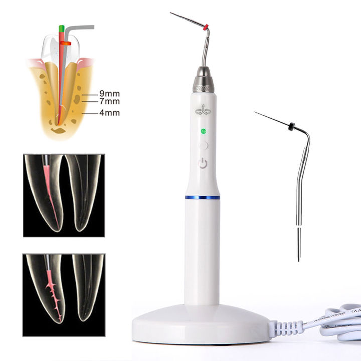 Dental Cordless Wireless Obturation System Endo Heat Pen + 2 Tips