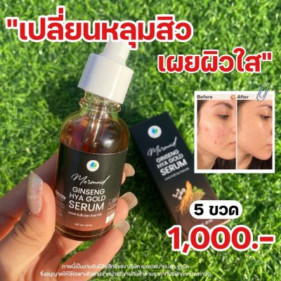 ❤️เซรั่มโสม Ginseng HYA GOLD Serum เมอเมด เซรั่มโสมทองไฮยา สิว ผิวแห้งคล้ำเสีย ไฮยาเซรั่ม อ่อนโยน 1 ขวด 30ml.