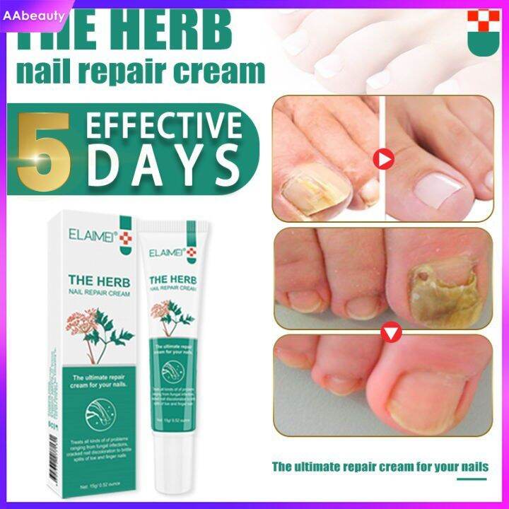 AAbeauty ELAIMEI Beauty nail fungus treatment Say goodbye to toenail
