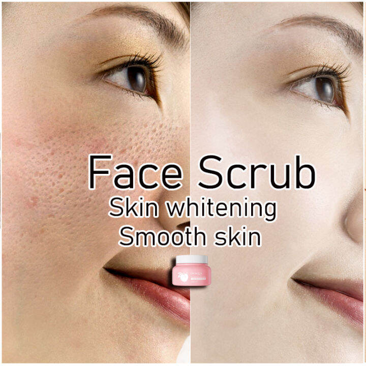Body Face Scrub skin whitening AntiAcne Remove dead skin Lazada
