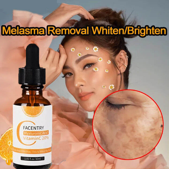 Vitamin C Serum/Melasma and Pekas Remover/Niacinamide Serum/Dark Spots