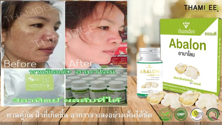 thamdee-abalon-เห็ดเป๋าฮื้อชนิดแคปซูล