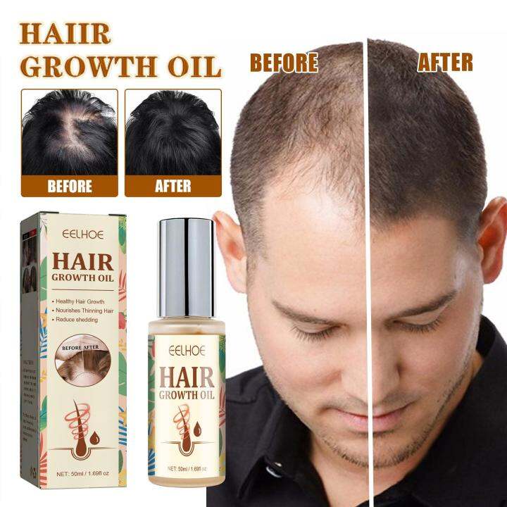 Hair Growth Essential oil Anti Hair Loss Serum Prevent Baldness ...