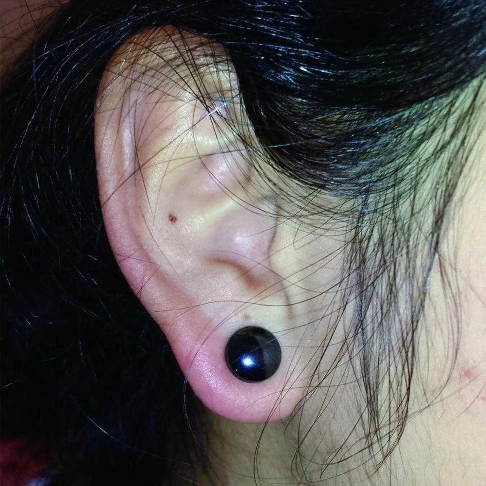 Update more than 151 acupuncture earrings for weight loss seven.edu.vn