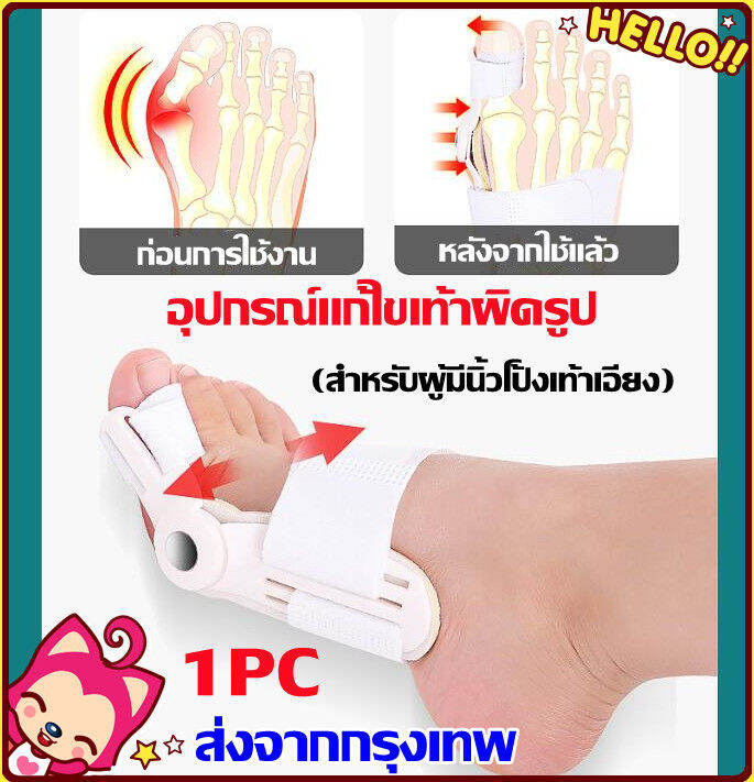 อุปกรณ์แก้ไขเท้าผิดรูป (สำหรับผู้มีนิ้วโป้งเท้าเอียง) อุปกรณ์ดัด