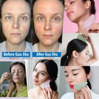 GUA SHA หน้าเนียนกระชับได้ได้รูป ลดอาการบวมต่างๆ ของหน้าหรือร่างกาย