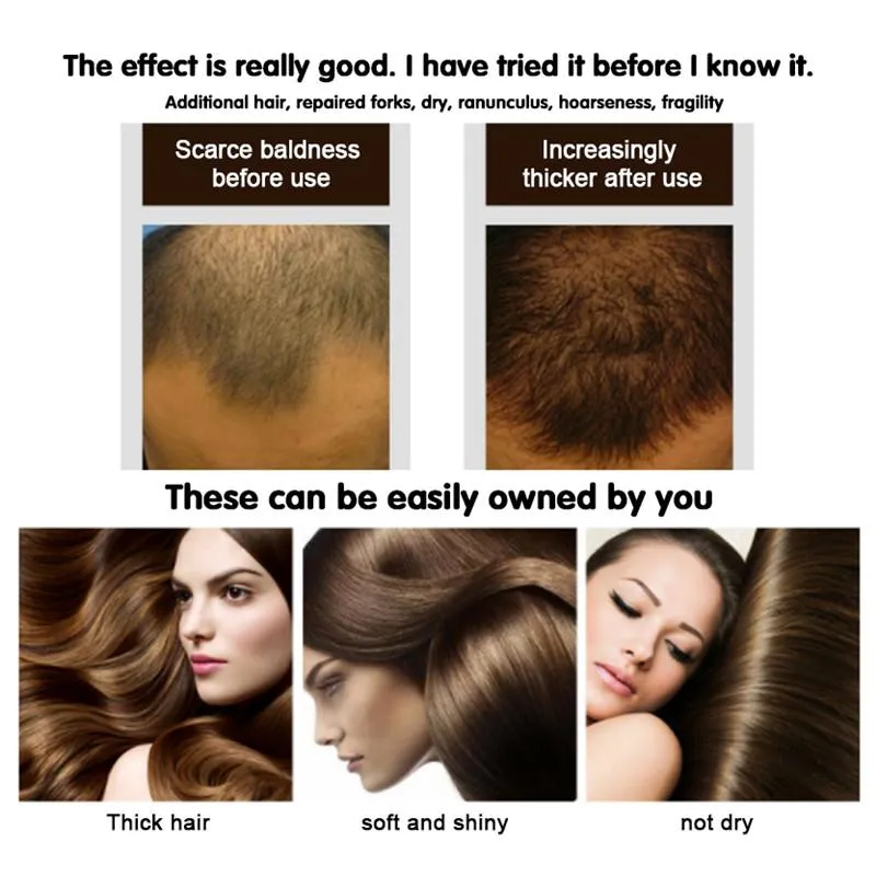 Aggregate more than 121 b12 hair loss vova.edu.vn