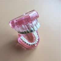 Dental Orthodontic Model With Metal And Ceramic  3003 Pink Brackets Dental Teeth Study