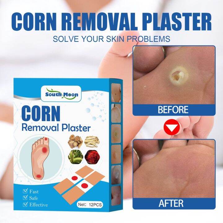 12แผ่น/กล่อง Corn Wart Remover Plaster Canopy Patch Plaster Corn Removal เห็นผลทันทีเมื่อใช้