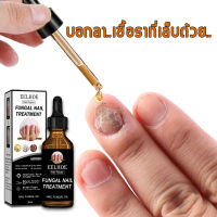 เซรั่มบำรุงเล็บ nail fungus เชื้อราเล็บมือ ซ่อมแซมเล็บเสีย กำจัดเล็บเสีย  ส่งเสริมการเจริญเติบโตของเล็บดีเยี่ยม ยากันเชื่อราเล็บ（เซรั่มซ่อมแซมเล็บ ครีมบำรุงเล็บ เชื้อราที่เล็บ ยาแก้เชื้อราที่เล็บ	ยาทาเชื้อราที่เล็บ เซรั่มเล็บขบ ยาใส่เล็บเป็นเชื้อรา）