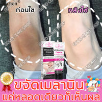 Aichun เครื่องดูดฝุ่นผิว ครีมทาผิวขาว ครีมทาก้นดำลาย （ ขาหนีบดำ ครีมรักแร้ขาว ครีมทารักแร้ดำ ครีมบำรุงรักแร้ ครีมทาก้นขาว ครีมทารักแร้ขาว ครีมเข่าขาว ครีมทาขาหนีบ ）ครีมทาคอ ไวท์เทนนิ่งและกระชับ ผิวคอเต่งตึง ริ้วรอยลำคอหายไปอย่างรวดเร็ว Armpit Cream