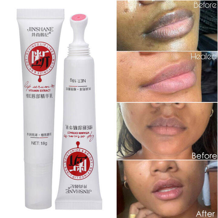 Dorisna Naturally Lips Pink Serum Fresh Lightening Lips Cream