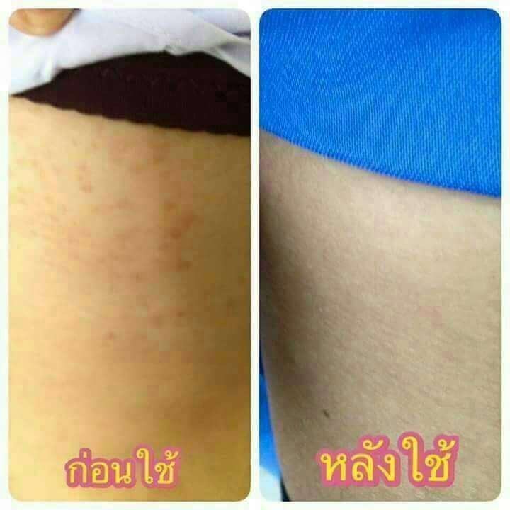 สบู่แครอทแก้สิวแก้ผิวมันมีปลายทางขนาด50กรัมก้อนใหญ่ใช้นานสบู่แครอทแก้สิวแก้ผิวมันมีปลายทางขนาด50กรัมก้อนใหญ่ใช้นาน