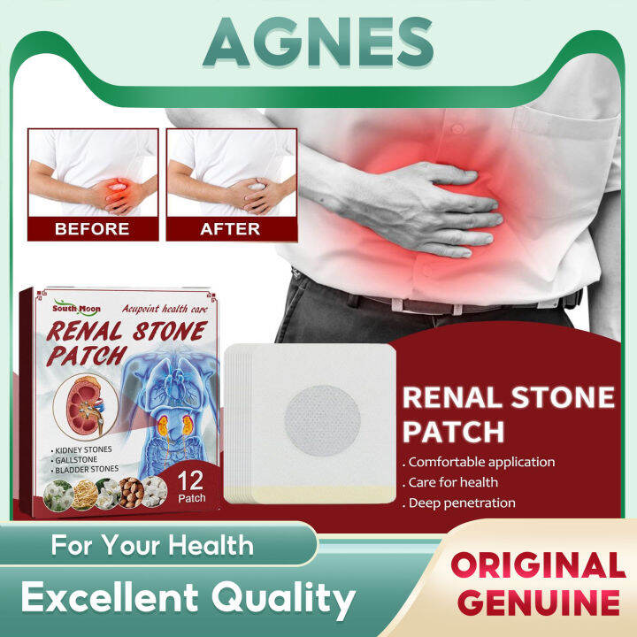 South Moon Renal Stone Patch Pain Relieving And Activating Collateral