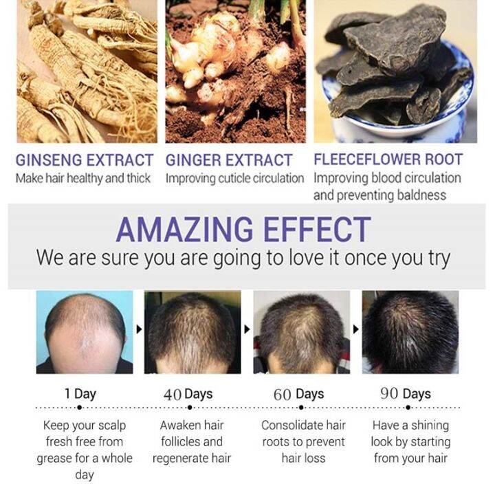 cw-ginger-hair-growth-products-fast-growing-hair-essential-oil-beauty-hair-care-prevent-hair-loss-oil-scalp-treatment-for-men-women