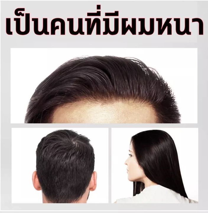 2-ขวด-1000ml-แชมพูขิง-แชมพูแก้ผมร่วง-ยับยั้งรังแค-แชมพูลดผมร่วง-แชมพูแก้ผมร่วง-แชมพูเร่งผมยาว-ยาสระผมแก้ร่วง-hair-loss-shampoo