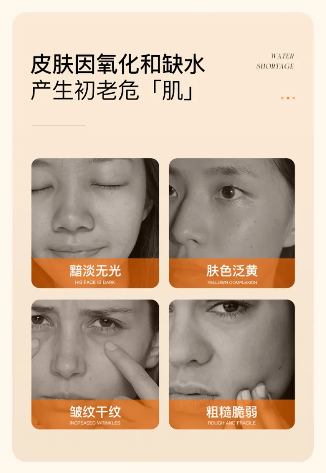 Top 153+ astaxanthin hair loss POPPY